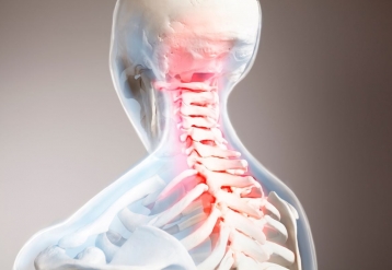 Spinal Cord Stimulation Holds Promise for Chronic Pain