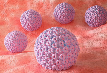 Thyroid Eye Disease Tied to Higher Prevalence of Human Papillomavirus