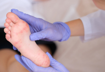 Review of U.S. Measles Elimination Status Delayed Until November