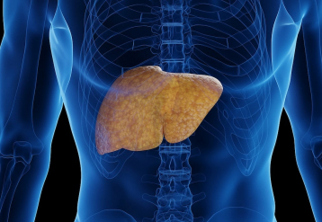 What To Know About Fatty Liver Disease and Why It’s So Common