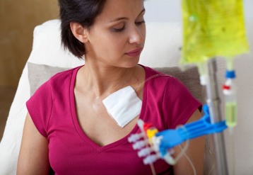 Bone Pain Reduced With Pegfilgrastim Administration 72 Hours After Chemo