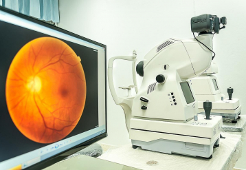 Variable Correlations Seen Between Geographic Atrophy Enlargement Rates in Fellow Eyes