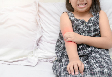 Recommendations Developed for Prevention of Pediatric Atopic Dermatitis