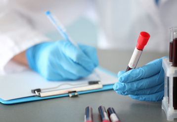 Most People Would Take A Blood Test For Alzheimer's, Study Says