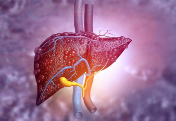 Fatty Liver Disease Tied to Higher Risk for Major Adverse Cardiovascular Events