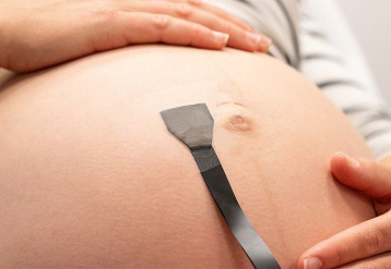 Viselhető ultrahang tapasz valós időben figyeli a magas kockázatú terhességeket